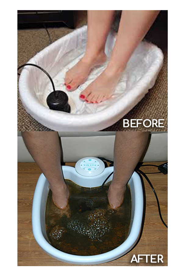 Foot Detox Before & After